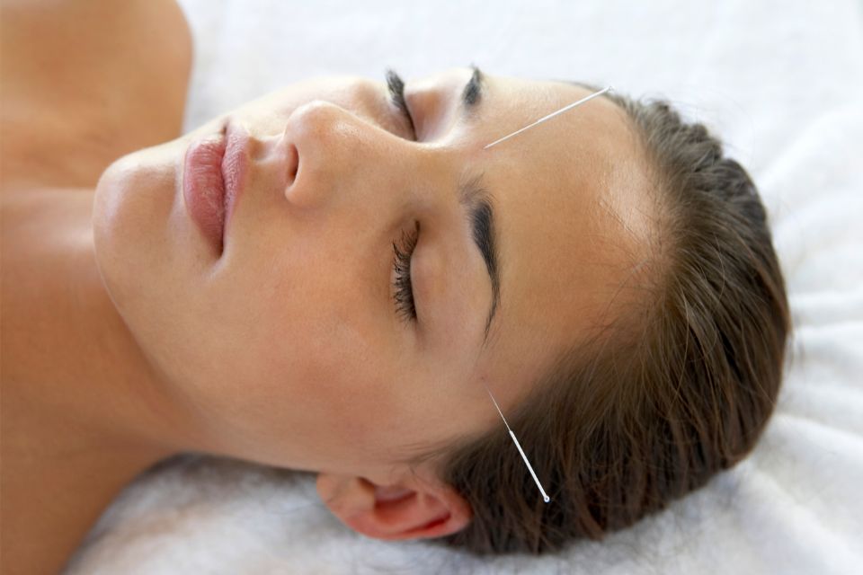 acupunctuur feiten fabels aki