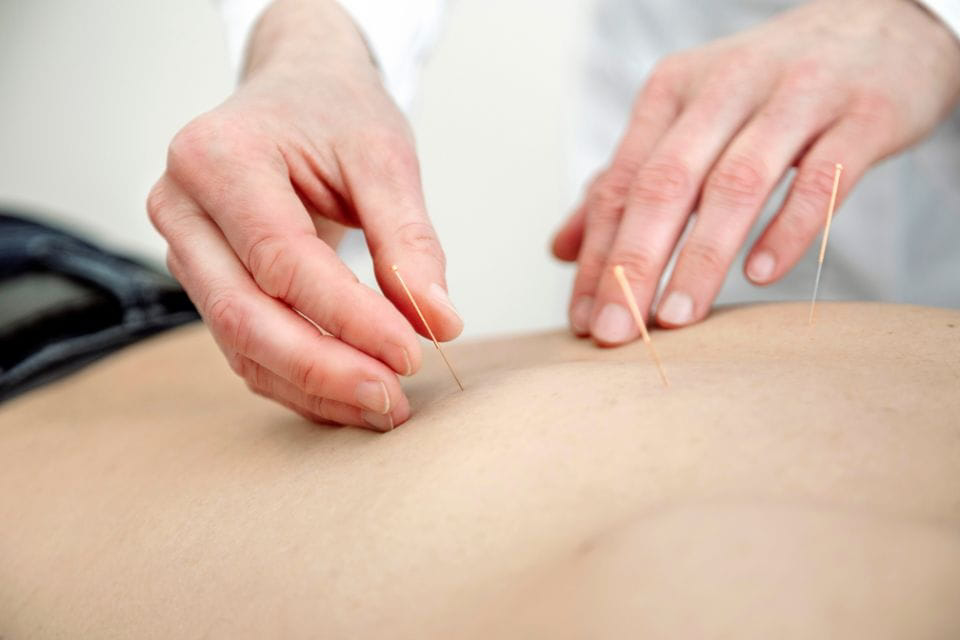 acupuncturist behandelt bij pijnklachten in Den Haag